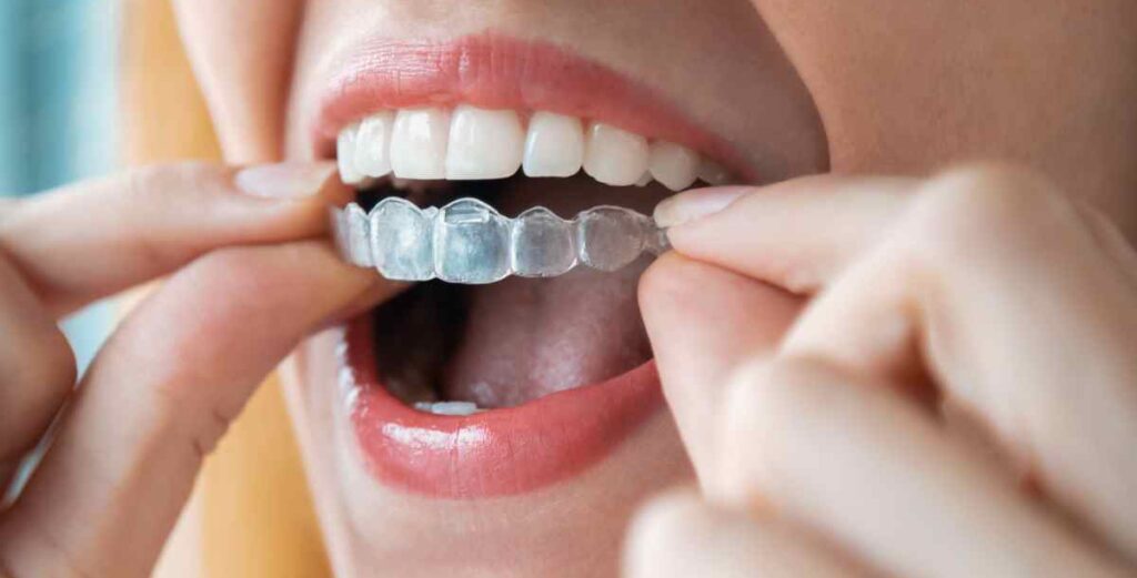 Orthodontic Treatment