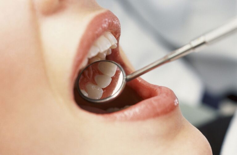 Common Dental Problems and How to Treat Them Solutions