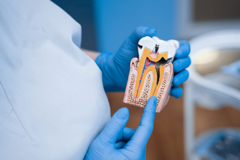 How Systemic Diseases Affect the Oral Cavity: What You Need to Know